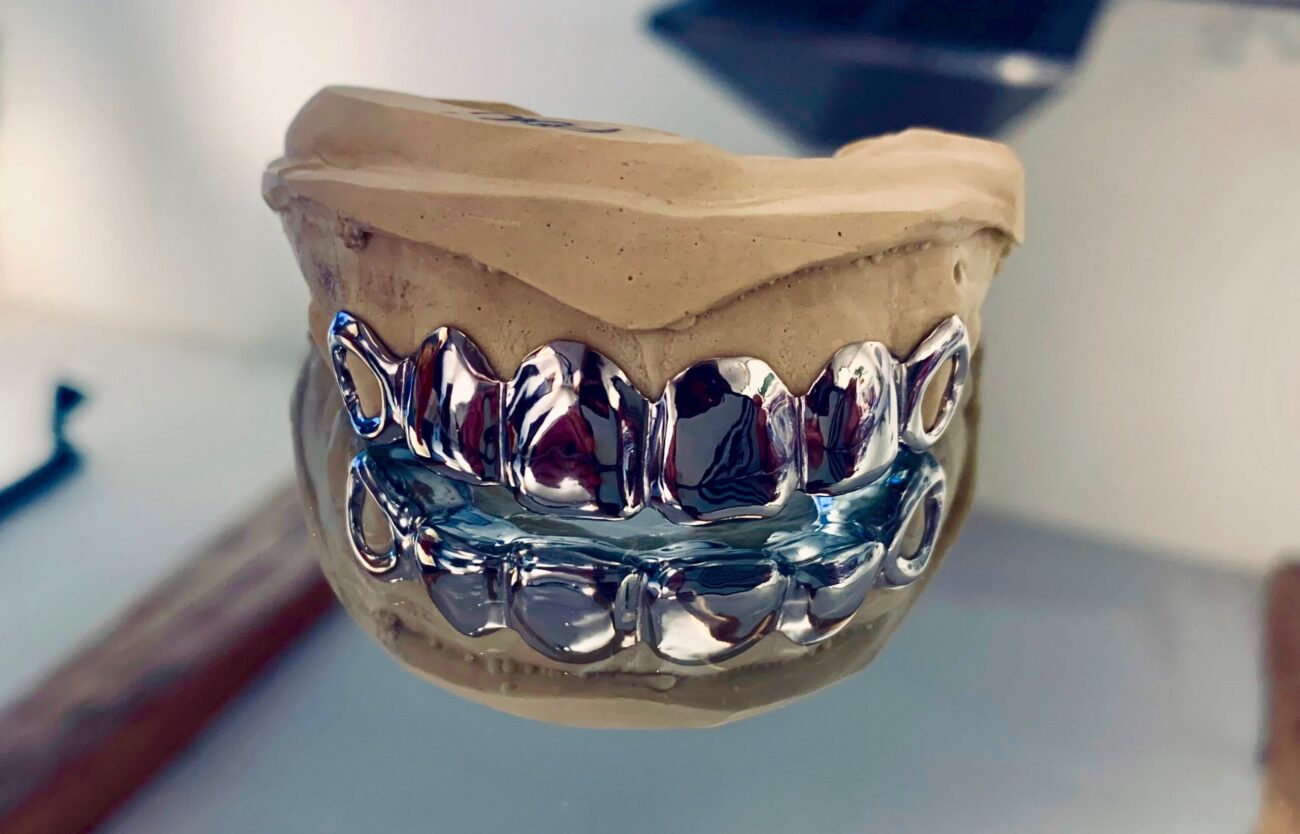 Où se faire faire un Grillz en Belgique 